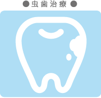 虫歯治療